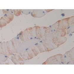 Phospholipase A2 Receptor 1 (PLA2R1) Antibody