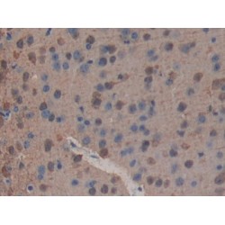 Phospholipase A2 Receptor 1 (PLA2R1) Antibody