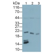 Western blot analysis of Mouse Pancreas (Lane 1), Rat Pancreas (Lane 2), Pig Pancreas (Lane 3) tissue lysates using Regenerating Islet Derived Protein 3 Beta (REG3b) Antibody (0.5 µg/ml) and and HRP-conjugated Goat Anti-Rabbit antibody (<a href="https://www.abbexa.com/index.php?route=product/search&amp;search=abx400043" target="_blank">abx400043</a>, 0.2 µg/ml).