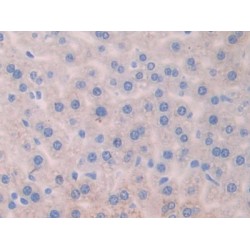 Angiogenic Factor With G Patch And FHA Domains 1 (AGGF1) Antibody