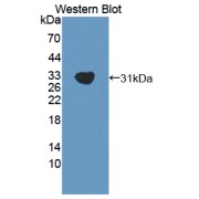 Western blot analysis of the recombinant protein.