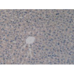 Aminoacyl tRNA Synthetase Complex Interacting Multifunctional Protein 1 (AIMP1) Antibody