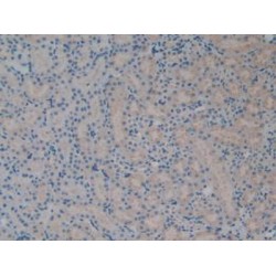 Aminoacyl tRNA Synthetase Complex Interacting Multifunctional Protein 1 (AIMP1) Antibody