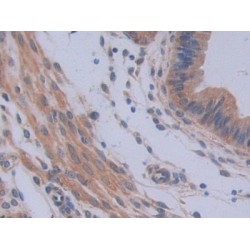 Interleukin 12A (IL12A) Antibody