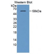 Western blot analysis of the recombinant protein.