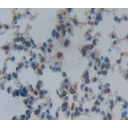 Oncostatin M Receptor (OSMR) Antibody