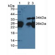 Western blot analysis of (1) Mouse Heart Tissue, (2) Mouse Skeletal Muscle Tissue and (3) Rat Skeletal Muscle Tissue.