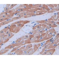 Myosin Light Chain 3 (MYL3) Antibody