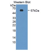 Western blot analysis of recombinant Human CTSG Protein (with N-terminal His and GST tags.