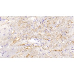 Cathepsin G (CTSG) Antibody