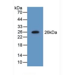 Non Metastatic Cells 5, Protein NM23A Expressed In (NME5) Antibody