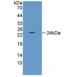 Leptin Receptor (LEPR) Antibody