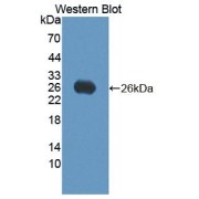 Western blot analysis of the recombinant protein.