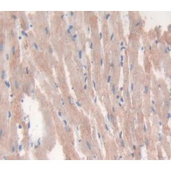 Vascular Endothelial Growth Factor B (VEGFB) Antibody