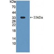 Western blot analysis of recombinant Mouse GP1Ba.