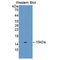 Sideroflexin 1 (SFXN1) Antibody