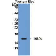 Western blot analysis of the recombinant protein.