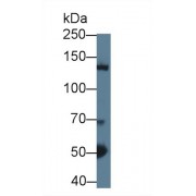 Western blot analysis of Mouse Cerebrum lysate, using Mouse HDAC4 Antibody (1 µg/ml) and HRP-conjugated Goat Anti-Rabbit antibody (<a href="https://www.abbexa.com/index.php?route=product/search&amp;search=abx400043" target="_blank">abx400043</a>, 0.2 µg/ml).