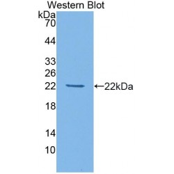 Histone Deacetylase 4 (HDAC4) Antibody