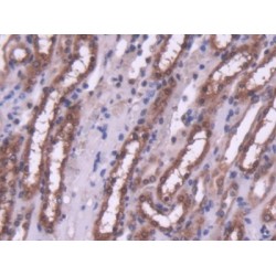 Histone Deacetylase 4 (HDAC4) Antibody