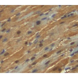 Kelch Like ECH Associated Protein 1 (KEAP1) Antibody