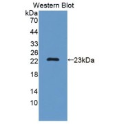 Western blot analysis of the recombinant protein.