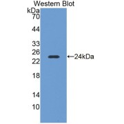 Western blot analysis of recombinant Mouse NEIL3.