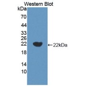 Western blot analysis of recombinant Pig IL18.