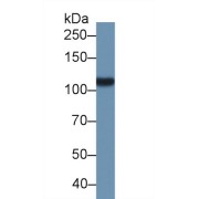 Western blot analysis of Pig Kidney lysate, using Pig GCPII Antibody (1 µg/ml) and HRP-conjugated Goat Anti-Rabbit antibody (<a href="https://www.abbexa.com/index.php?route=product/search&amp;search=abx400043" target="_blank">abx400043</a>, 0.2 µg/ml).