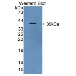 Glutamate Carboxypeptidase II (GCPII) Antibody