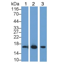 Myoglobin (MB) Antibody