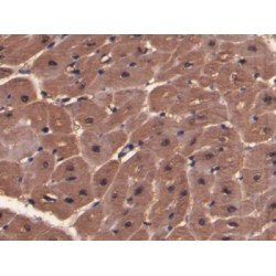 Myoglobin (MB) Antibody