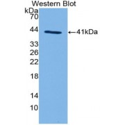 Western blot analysis of recombinant Pig C3a (with N-terminal His and GST tags).