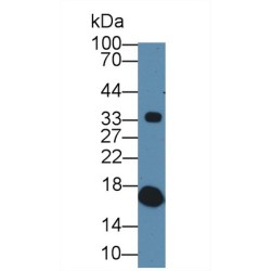 Transthyretin (TTR) Antibody