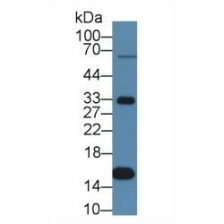 Transthyretin (TTR) Antibody