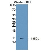 Western blot analysis of the recombinant protein.