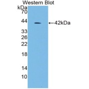 Western blot analysis of the recombinant protein.