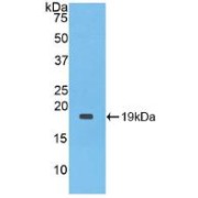 Western blot analysis of recombinant Rabbit IL1RA.