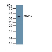 Western blot analysis of recombinant Rat MT1.