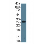 Western blot analysis of Rat Serum, using Rat MBL Antibody (1 µg/ml) and HRP-conjugated Goat Anti-Rabbit antibody (<a href="https://www.abbexa.com/index.php?route=product/search&amp;search=abx400043" target="_blank">abx400043</a>, 0.2 µg/ml).