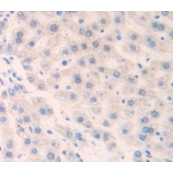 Mannose Binding Lectin (MBL) Antibody