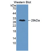 Western blot analysis of the recombinant protein.