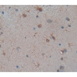 Dopamine Transporter / DAT (SLC6A3) Antibody