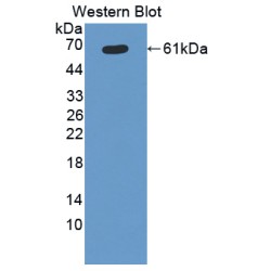 Cytochrome P450 11B1 (CYP11B1) Antibody