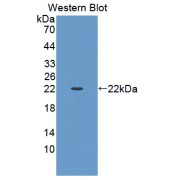 Western blot analysis of the recombinant protein.