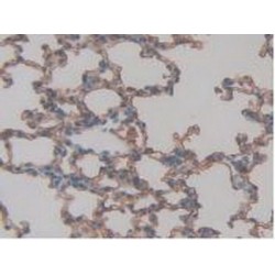 Advanced Glycosylation End Product Specific Receptor (AGER) Antibody