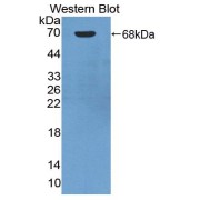 Western blot analysis of the recombinant protein.