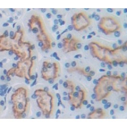 Ectonucleotide Pyrophosphatase/Phosphodiesterase 2 (ENPP2) Antibody