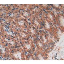 Angiopoietin-1 Receptor / TIE2 (TEK) Antibody