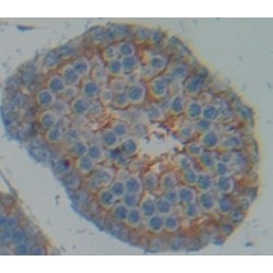 A Disintegrin And Metalloprotease 17 (ADAM17) Antibody